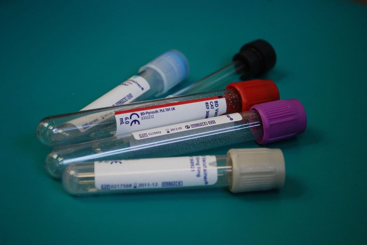 Laboratory sample tubes